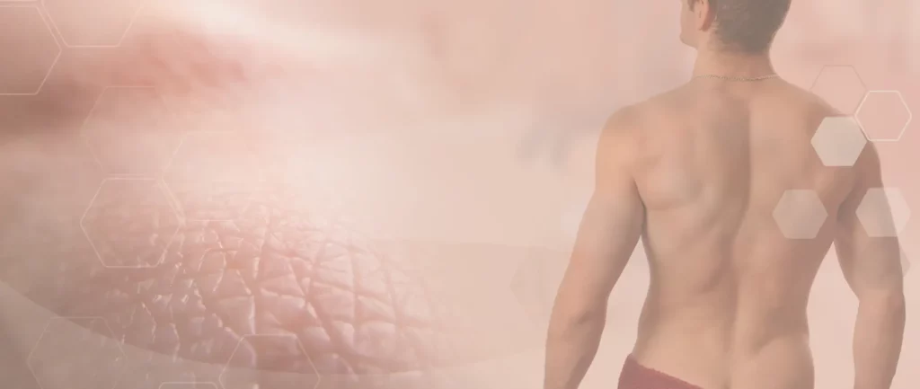 Bannerbild Mann mit haarlosem Rücken und Nacken