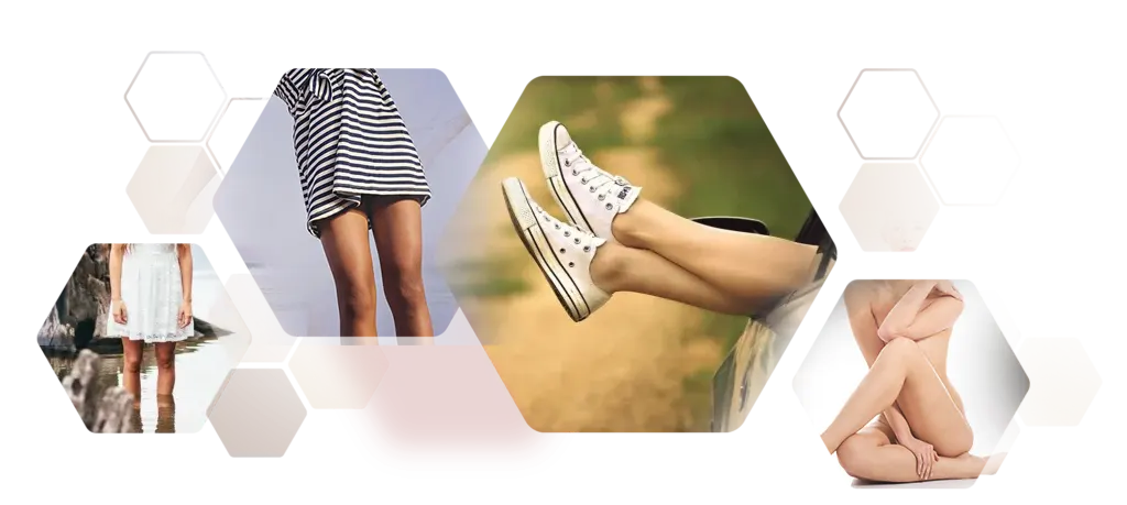 Fotocollage Wabenmuster mit glatten Beinen dank der Haarentfernung für Frauen