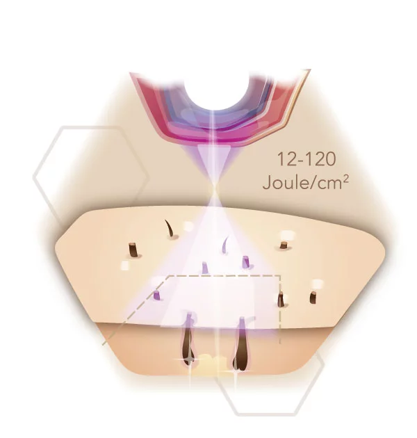 Infografik Energielevel von IPL